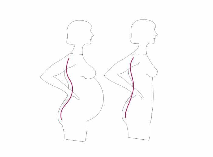 Rückenschmerzen Schwangerschaft